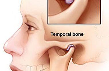 Scared of Jaw Pain? TMJ Treatment at Decoteau Orthodontics is Your Halloween Hero! 👻🎃