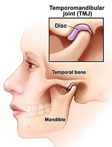 Scared of Jaw Pain? TMJ Treatment at Decoteau Orthodontics is Your Halloween Hero! 👻🎃